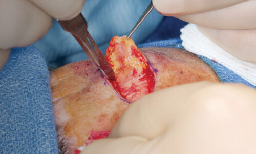 Plastic surgery – Learn Online from BAPRAS & HEE