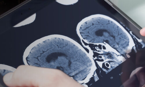 Radiology – Learn Online from RCR & HEE